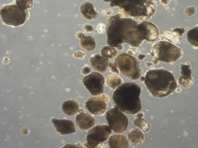 Generation of Myospheres From hESCs by Epigenetic Reprogramming