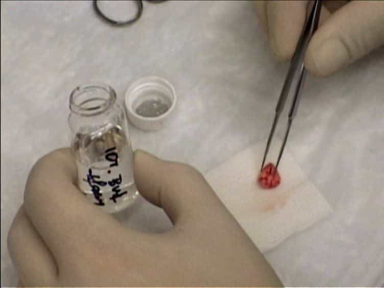 A Mouse Tumor Model of Surgical Stress to Explore the Mechanisms of Postoperative Immunosuppression and Evaluate Novel Perioperative Immunotherapies