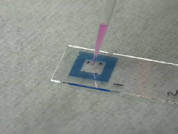 Demonstrating a Multi-drug Resistant Mycobacterium tuberculosis Amplification Microarray