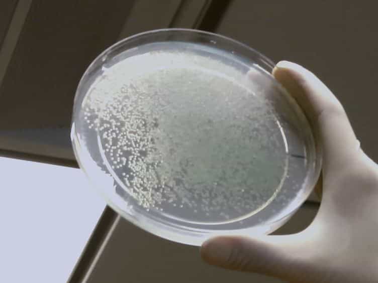Identification of Novel Genes Associated with Alginate Production in Pseudomonas aeruginosa Using Mini-himar1 Mariner Transposon-mediated Mutagenesis