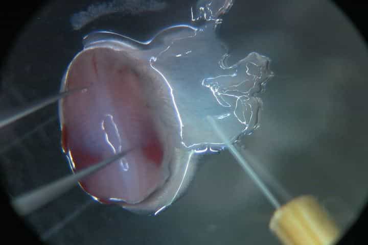Ex vivo Culture of Mouse Embryonic Skin and Live-imaging of Melanoblast Migration
