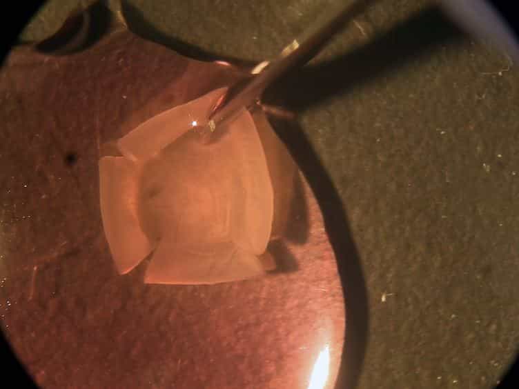 Immunohistochemical and Calcium Imaging Methods in Wholemount Rat Retina