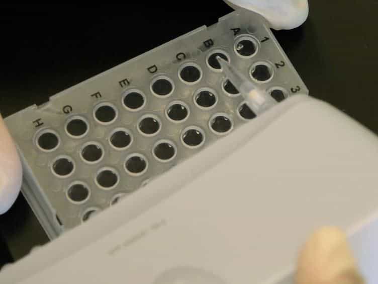 Profiling Individual Human Embryonic Stem Cells by Quantitative RT-PCR
