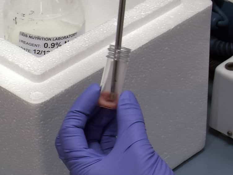 The Use of Gas Chromatography to Analyze Compositional Changes of Fatty Acids in Rat Liver Tissue during Pregnancy