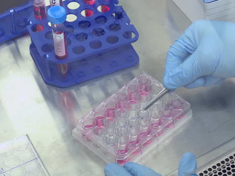 A Modified In vitro Invasion Assay to Determine the Potential Role of Hormones, Cytokines and/or Growth Factors in Mediating Cancer Cell Invasion