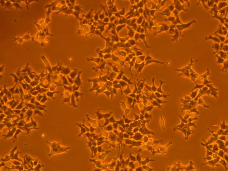 Characterization of G Protein-coupled Receptors by a Fluorescence-based Calcium Mobilization Assay