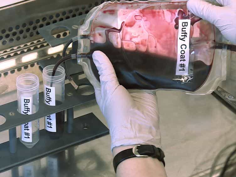 Isolation of Human Monocytes by Double Gradient Centrifugation and Their Differentiation to Macrophages in Teflon-coated Cell Culture Bags