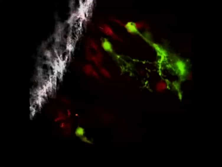 Acute Brain Trauma in Mice Followed By Longitudinal Two-photon Imaging
