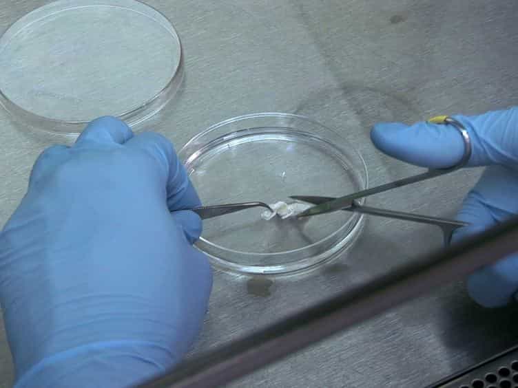 Surgical Retrieval, Isolation and In vitro Expansion of Human Anterior Cruciate Ligament-derived Cells for Tissue Engineering Applications