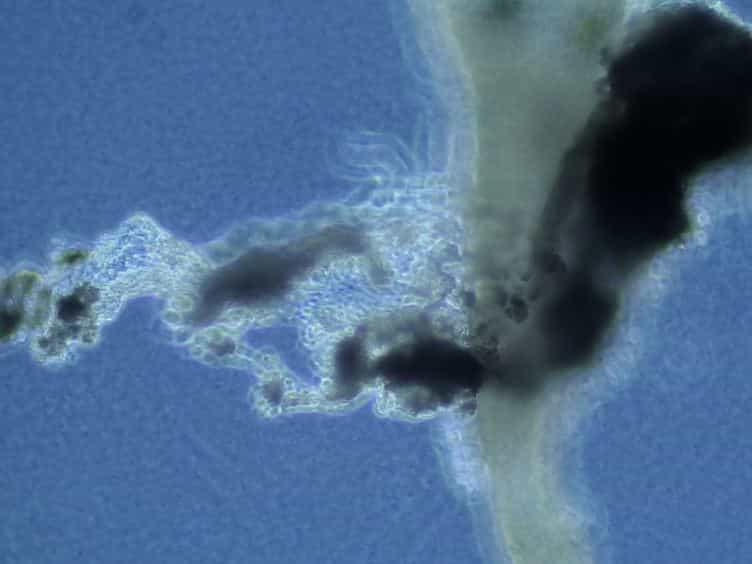 Isolation of Neonatal Extrahepatic Cholangiocytes