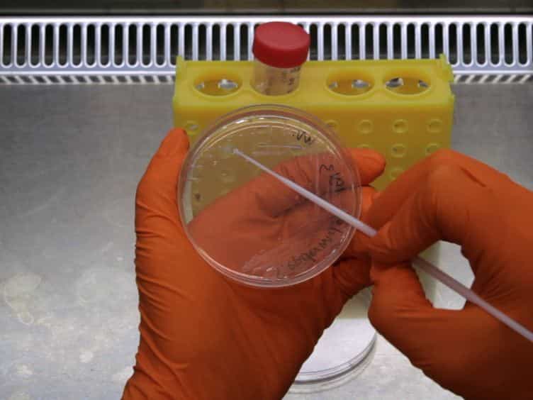 Establishment and Optimization of a High Throughput Setup to Study Staphylococcus epidermidis and Mycobacterium marinum Infection as a Model for Drug Discovery