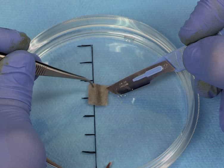 Transplantation of Tail Skin to Study Allogeneic CD4 T Cell Responses in Mice