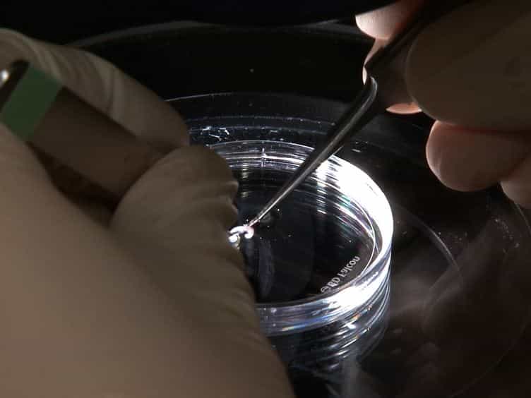 In Vitro Pancreas Organogenesis from Dispersed Mouse Embryonic Progenitors