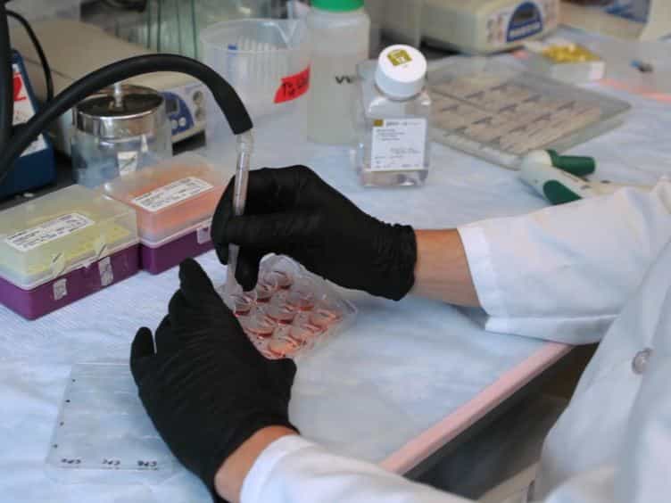 An Immunofluorescent Method for Characterization of Barrett’s Esophagus Cells
