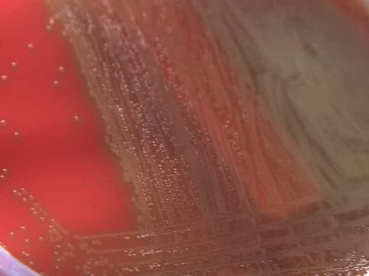 Capsular Serotyping of Streptococcus pneumoniae by Latex Agglutination