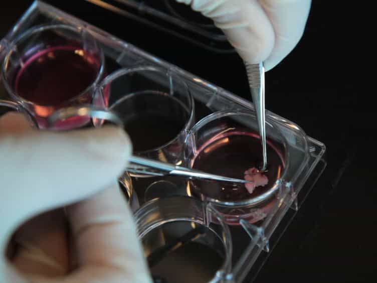 Isolation, Identification, and Purification of Murine Thymic Epithelial Cells