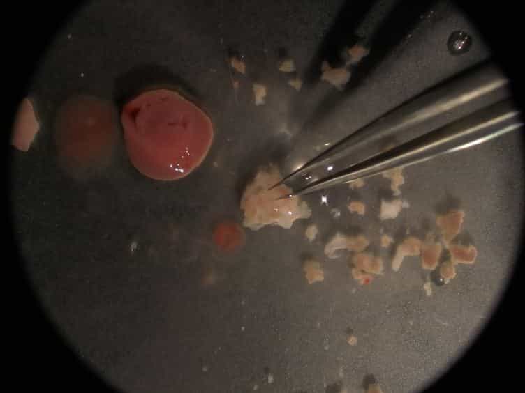 Isolation of Murine Valve Endothelial Cells