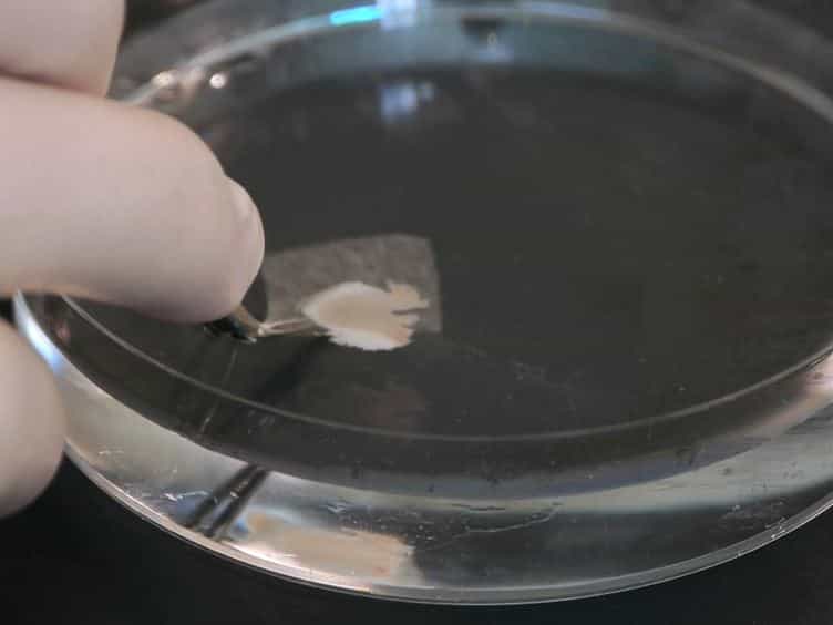 Multi-electrode Array Recordings of Human Epileptic Postoperative Cortical Tissue