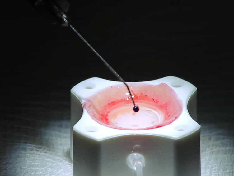 Corneal Donor Tissue Preparation for Descemet's Membrane Endothelial Keratoplasty