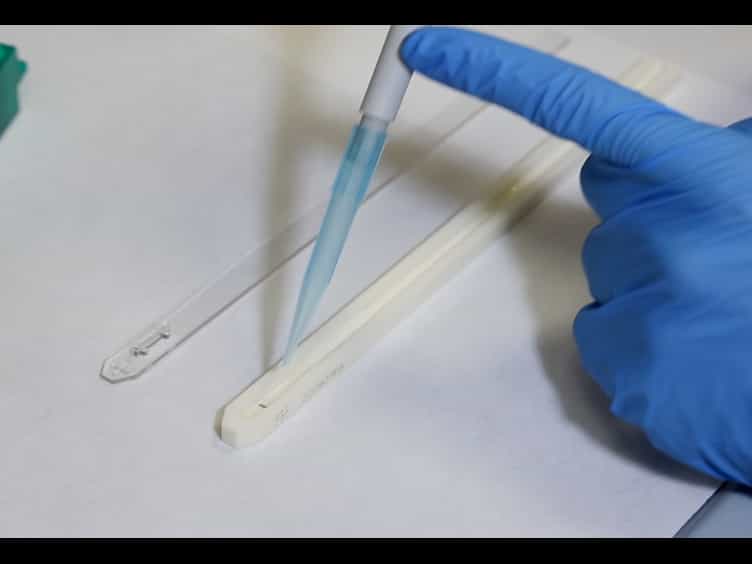 From a 2DE-Gel Spot to Protein Function: Lesson Learned From HS1 in Chronic Lymphocytic Leukemia