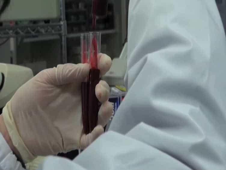 Preparation of Rat Serum Suitable for Mammalian Whole Embryo Culture