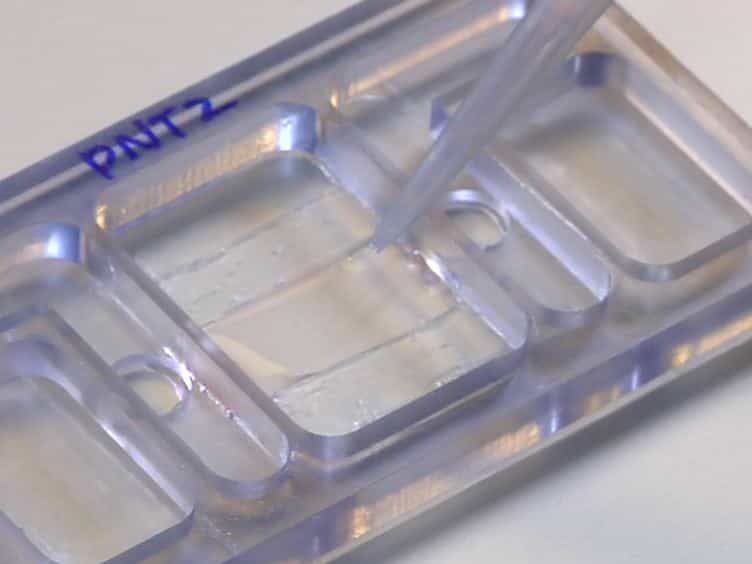 Utilizing Custom-designed Galvanotaxis Chambers to Study Directional Migration of Prostate Cells