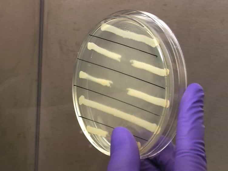Non-Invasive Model of Neuropathogenic Escherichia coli Infection in the Neonatal Rat