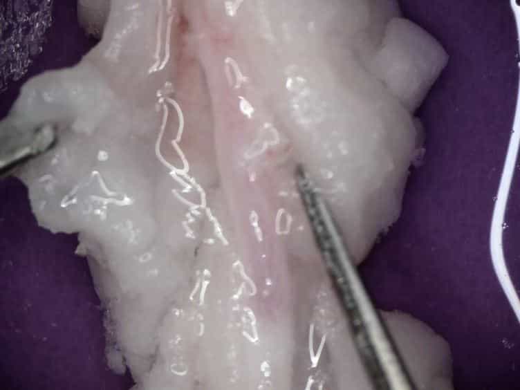 Isolating and Using Sections of Bovine Mesenteric Artery and Vein as a Bioassay to Test for Vasoactivity in the Small Intestine