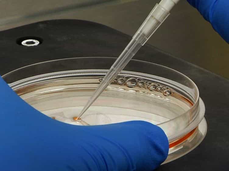 Generation of Induced Pluripotent Stem Cells from Muscular Dystrophy Patients: Efficient Integration-free Reprogramming of Urine Derived Cells