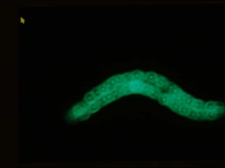 Methods to Assess Subcellular Compartments of Muscle in C. elegans