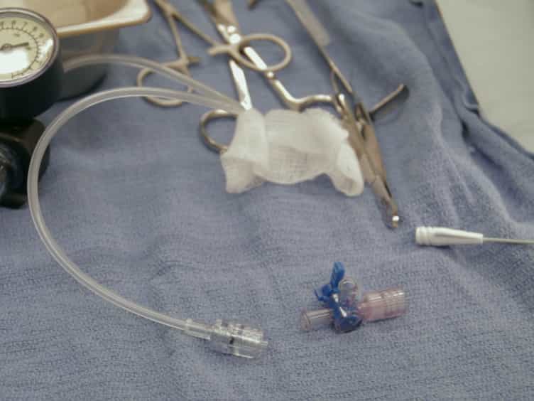 Vascular Balloon Injury and Intraluminal Administration in Rat Carotid Artery