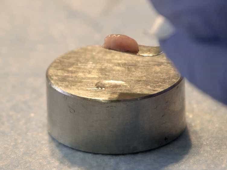 Slice It Hot: Acute Adult Brain Slicing in Physiological Temperature