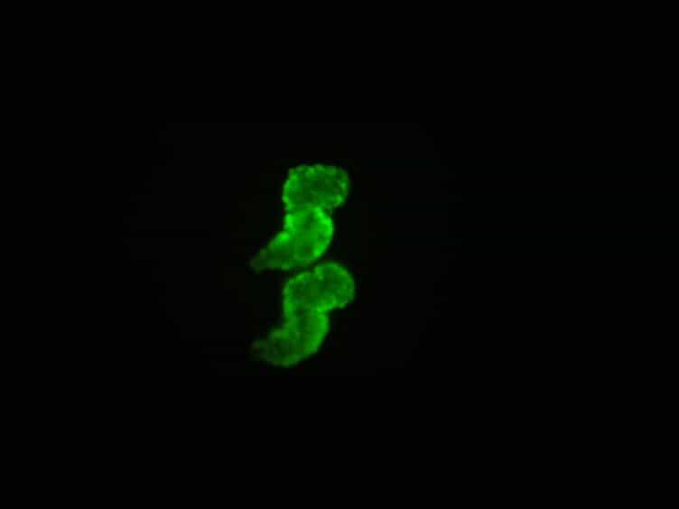 Large-scale Zebrafish Embryonic Heart Dissection for Transcriptional Analysis