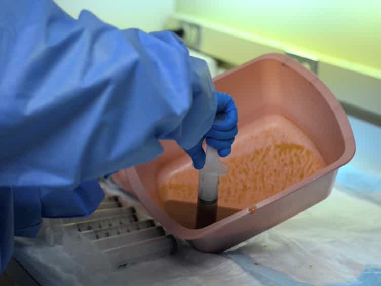 Fecal Microbiota Transplantation via Colonoscopy for Recurrent C. difficile Infection