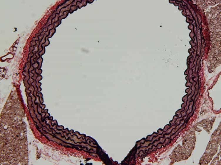 Isolation and Excision of Murine Aorta; A Versatile Technique in the Study of Cardiovascular Disease