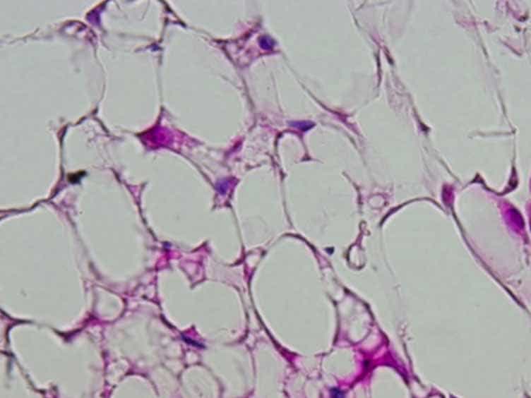 Localization, Identification, and Excision of Murine Adipose Depots