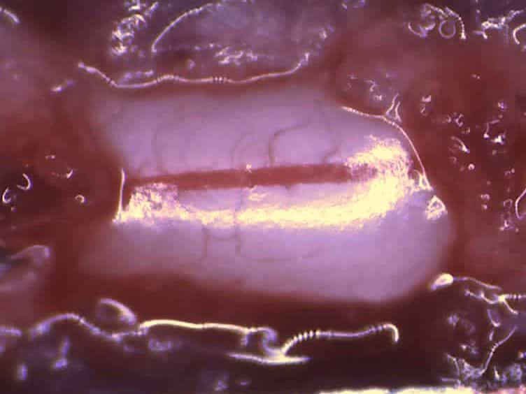 A Procedure for Implanting a Spinal Chamber for Longitudinal In Vivo Imaging of the Mouse Spinal Cord