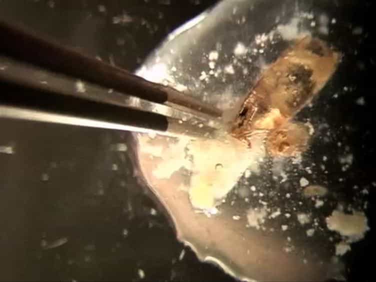 Dissection and Mounting of Drosophila Pupal Eye Discs