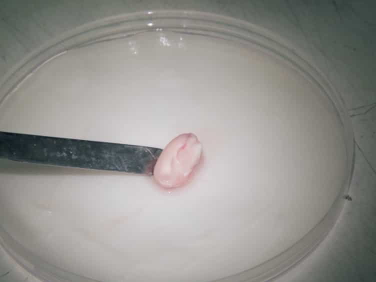 Organotypic Slice Cultures for Studies of Postnatal Neurogenesis