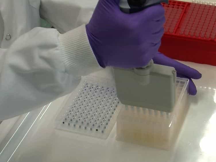 Green Fluorescent Protein-based Expression Screening of Membrane Proteins in Escherichia coli