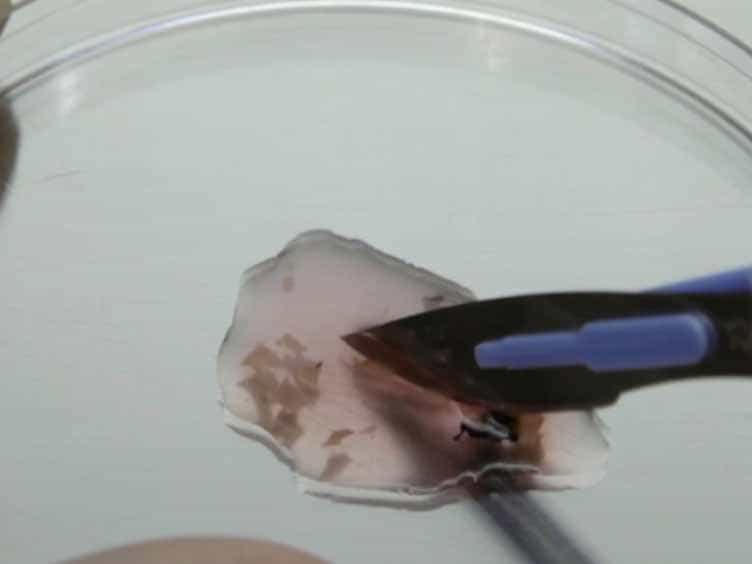A Simple and Rapid Protocol to Non-enzymatically Dissociate Fresh Human Tissues for the Analysis of Infiltrating Lymphocytes