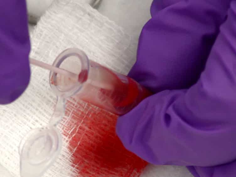 Physiology Lab Demonstration: Glomerular Filtration Rate in a Rat