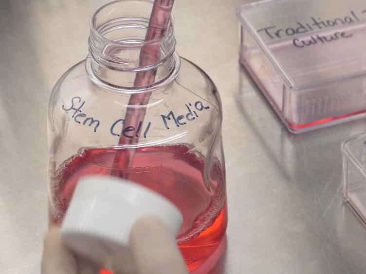 In vitro Enrichment of Ovarian Cancer Tumor-initiating Cells