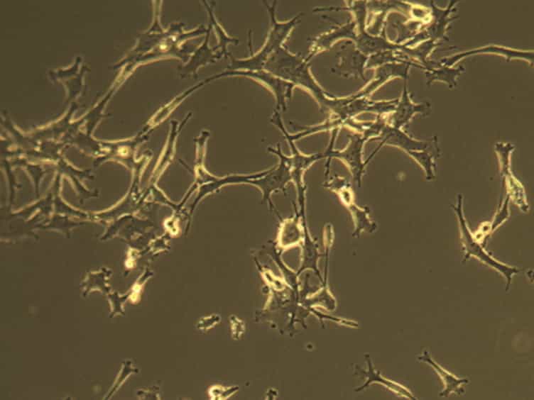 Using Mouse Mammary Tumor Cells to Teach Core Biology Concepts: A Simple Lab Module