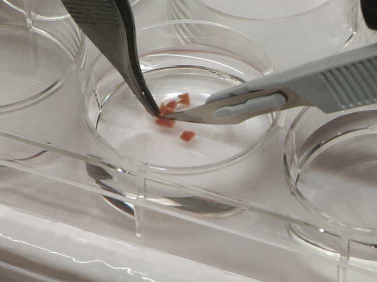 Isolation of Primary Human Colon Tumor Cells from Surgical Tissues and Culturing Them Directly on Soft Elastic Substrates for Traction Cytometry
