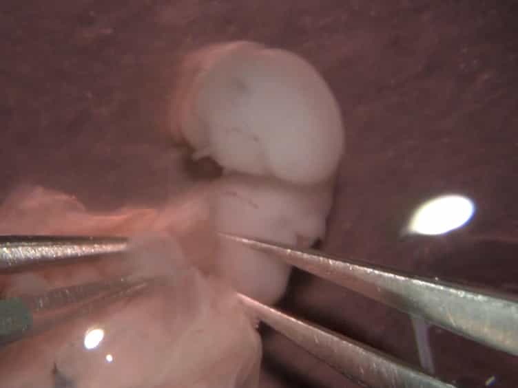 Ex Utero Electroporation and Organotypic Slice Culture of Mouse Hippocampal Tissue