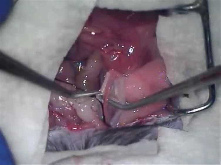 A Murine Model of Irreversible and Reversible Unilateral Ureteric Obstruction