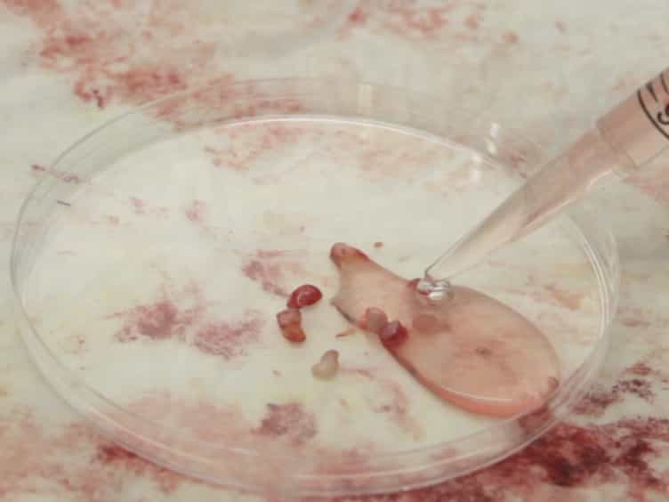 Lymphocyte Isolation from Human Skin for Phenotypic Analysis and Ex Vivo Cell Culture