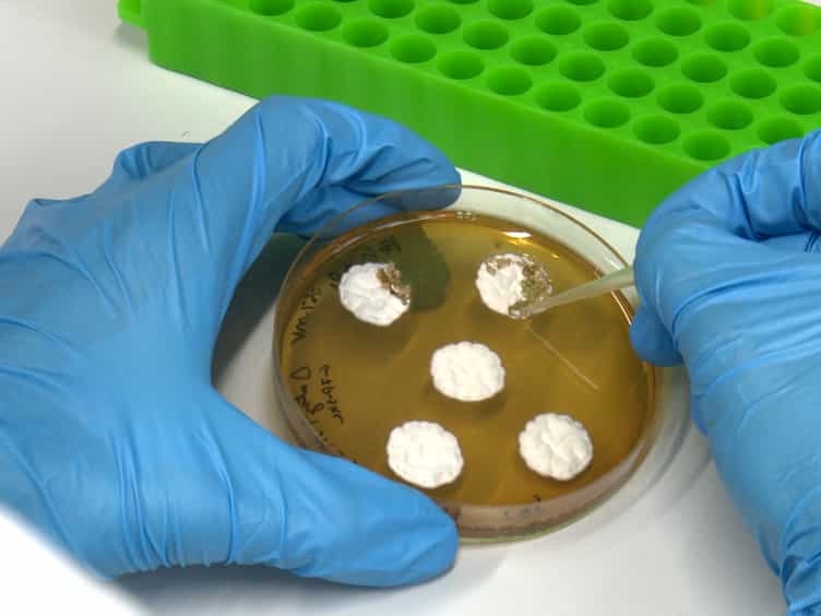 Analysis of Autophagy in Penicillium chrysogenum by Using Starvation Pads in Combination With Fluorescence Microscopy