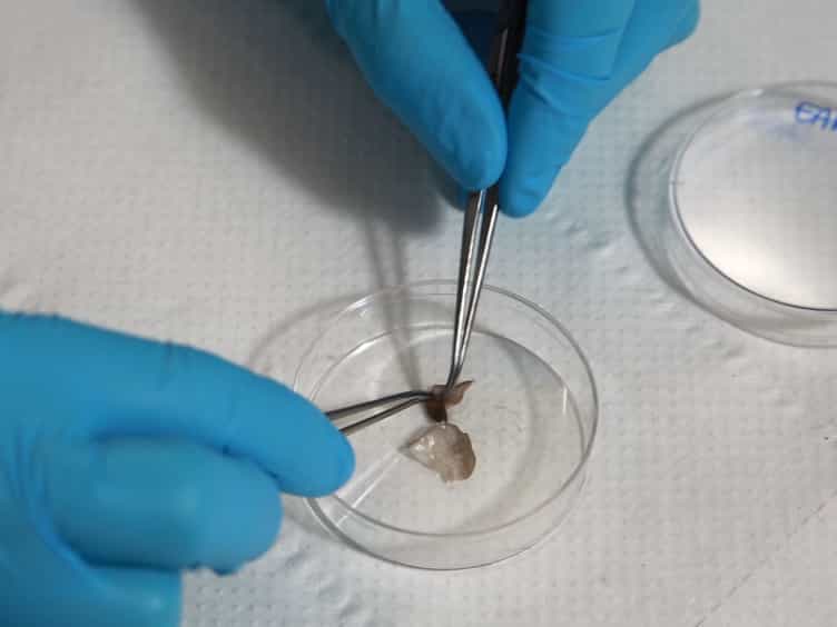 Preparation of Single-cell Suspensions for Cytofluorimetric Analysis from Different Mouse Skin Regions
